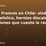 Bulldog Frances en Chile: sindrome braquicefalico, hernias discales y los $10 millones que cuesta la raza de moda